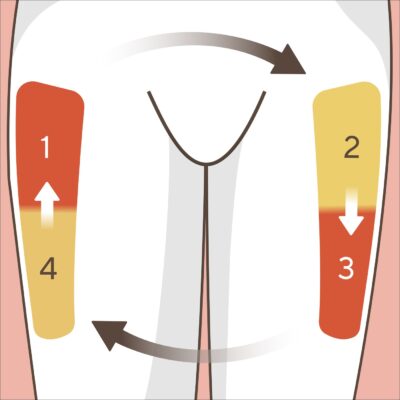 Die Illustration zeigt die Oberschenkel. Der eine Oberschenkel zeigt zwei Bereiche, die oben mit 1 und darunter mit 4 markiert sind. Der andere Oberschenkel zeigt zwei Bereiche, der obere ist mit 2 beschriftet, der untere mit 3. Pfeile zeigen vom Bereich 1 zu 2, dann zu 3 zu 4. 